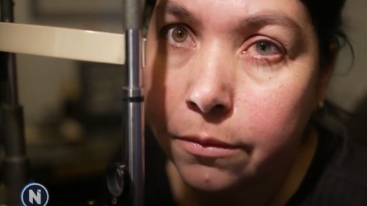 Heterocromía, la causa de tener ojos de diferente color