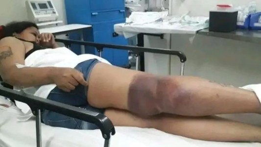 Quiso consultar el saldo de su SUBE en una terminal automática y recibió una descarga eléctrica: deberá ser operada