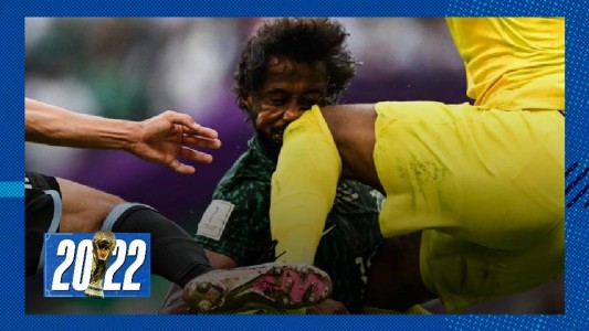 Afuera del Mundial: Al Shahrani sufrió fractura de mandíbula y fue operado