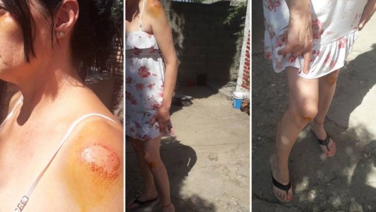 En barrio Los Químicos se roban hasta los portones