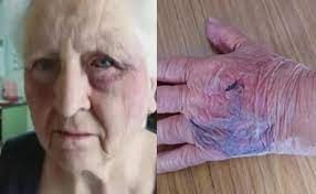 Asaltaron y golpearon a una pareja de jubilados y ahora se quieren ir de su casa