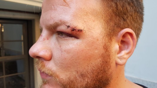 Hay 6 detenidos por el ataque al periodista en Carlos Paz