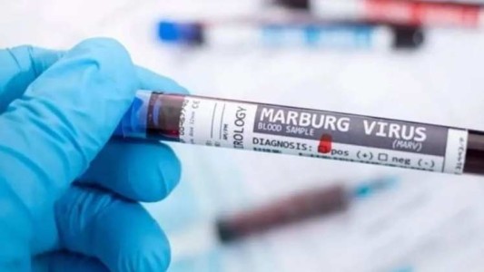 Virus de Marburgo: la OMS aumenta la vigilancia sanitaria