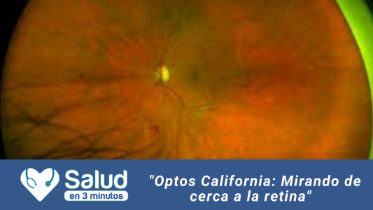 Optos California: ¿Se puede ver toda la retina?