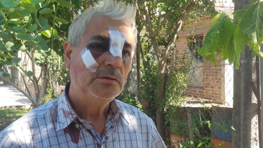 Violento asalto a un carnicero en barrio Santa Isabel