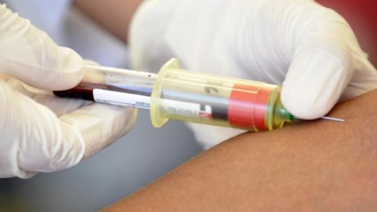 Un tercer enfermo de VIH logra curarse tras un trasplante de células madre