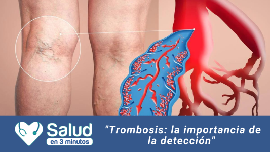 Trombosis: ¿Se pueden prevenir? ¿Cómo puede ser tratadas?
