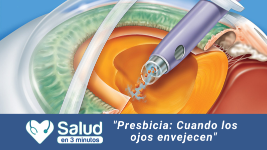 Presbicia: Cuando los ojos envejecen