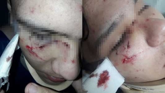 Brutal agresión a joven a la salida de una escuela en Yocsina