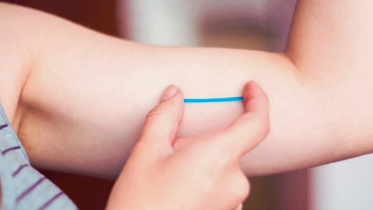 Salta: Colocarán implantes subdérmicos anticonceptivos a mujeres de hasta 19 años