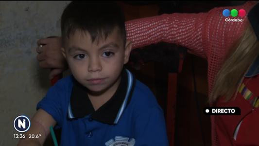 La conmovedora historia de Isaías, el niño que se recupera tras estar a punto de perder un brazo