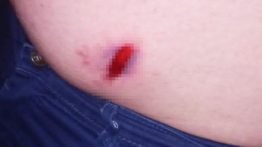 Roban el arma reglamentaria a un policía de Córdoba y le disparan en el abdomen