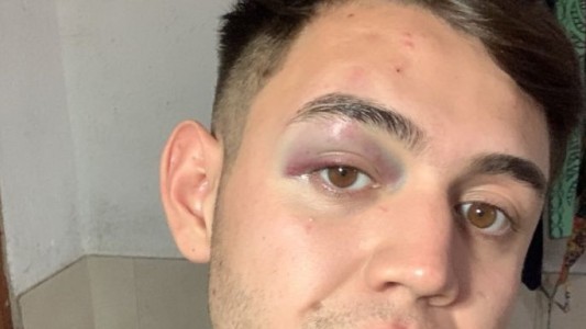 Brutal paliza a un grupo de jóvenes en un boliche de Carlos Paz por personal de seguridad