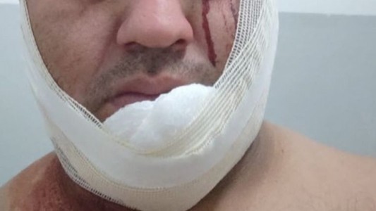 Apuñalaron a un taxista: le cortaron el cuello para robarle