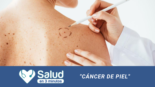 Cáncer de piel: La importancia de protegernos de los rayos UV todo el año