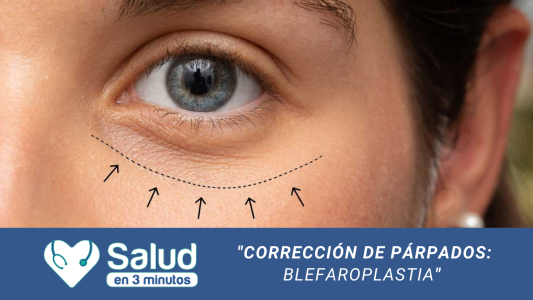 Blefaroplastia: La solución para poder recuperar la apertura de los ojos