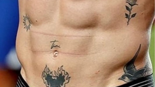 Cómo se borra un tatuaje como el que tiene De Paul con el nombre de Tini