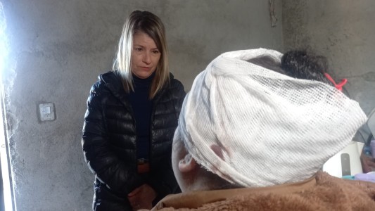 Habló la mujer que fue baleada en la nuca por su ex pareja: “Me salvé por dos milímetros”