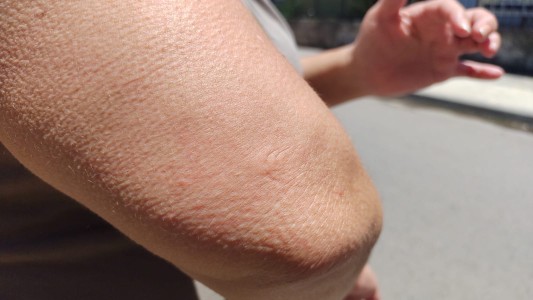 Dengue: la provincia intensifica acciones para combatir el mosquito