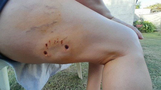 Nuevo ataque de perro peligroso