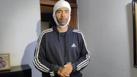 Robo y una golpiza sangrienta: un nuevo robo piraña en Córdoba