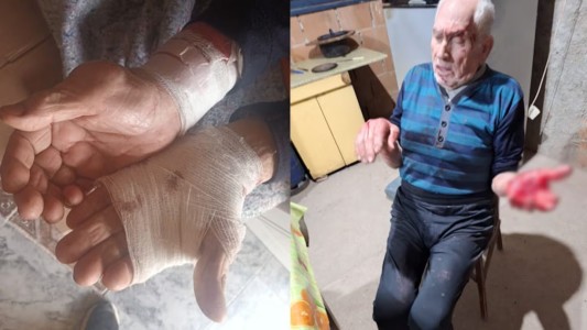 Bialet Massé: un jubilado de 77 años fue brutalmente golpeado y asaltado