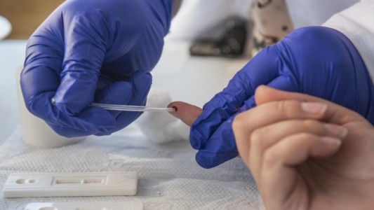 Seis pacientes trasplantados dan positivo de VIH tras recibir órganos infectados en Río de Janeiro