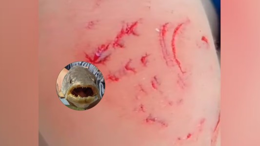 Video: una tararira atacó a un nene en el río Anisacate