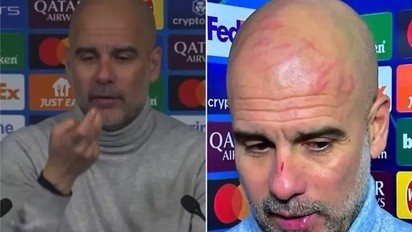 Guardiola apareció con rasguños en la cabeza tras la remontada de Feyenoord ante Manchester City: la explicación del entrenador