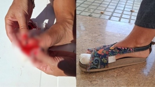 Una rosarina fue atacada por una palometa en el Paraná y alertó a los bañistas