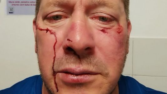 Córdoba: golpearon brutalmente a un empleado para robarle su bicicleta mientras se dirigía a trabajar