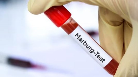 Murieron ocho personas por posible brote de la enfermedad del virus de Marburgo en Tanzania