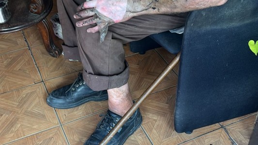 Un hombre se lesionó cuando intentaba reparar una falla eléctrica