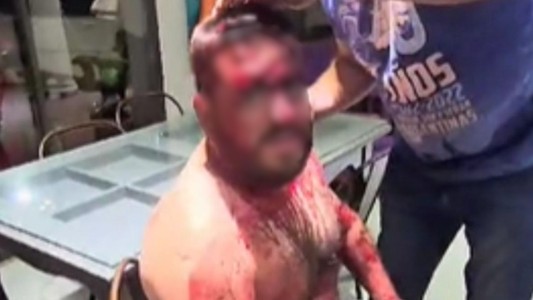 Violento robo en un country de Córdoba: lo golpearon tanto que perdió dos litros de sangre