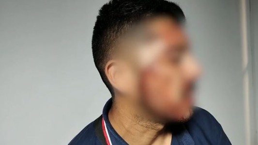 Hirieron a un chofer: paro de colectivos en zona oeste del AMBA