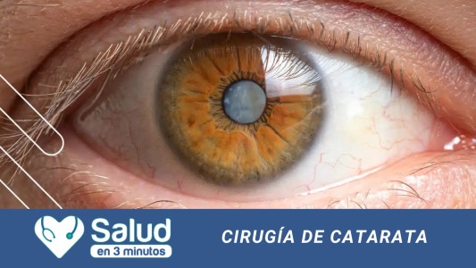 ¿Cuáles son los avances en la cirugía de Catarata?
