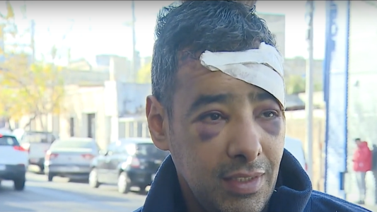 Un actor fue robado y brutalmente golpeado antes de estrenar su obra