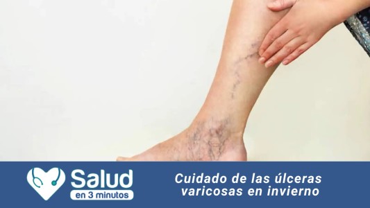 Úlceras Varicosas en invierno: ¿Cómo las tratamos?