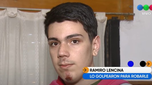 El adolescente con Asperger que perdió dos dientes en un asalto recuperó su sonrisa