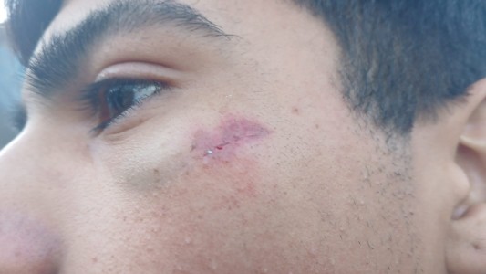 Batalla campal: todo empezó por un buzo