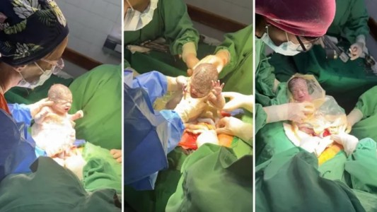 Un caso que sucede cada un millón: nacieron trigemelas en Salta