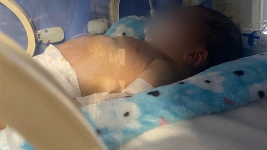 Recibió el alta el bebé que luchó cinco meses tras ser afectado por fentanilo contaminado