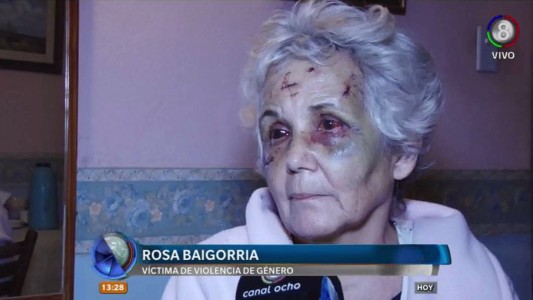 Violencia de género: Abuela brutalmente golpeada por su pareja