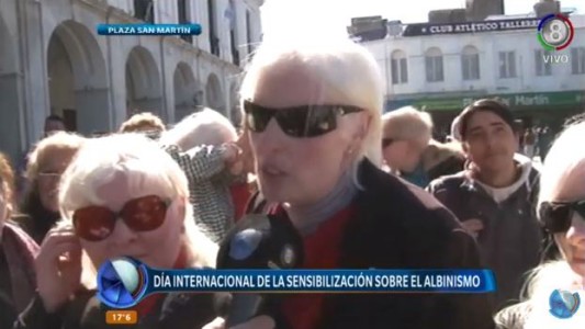 En el día Internacional de la Sensibilización del Albino le dicen no a la discriminación
