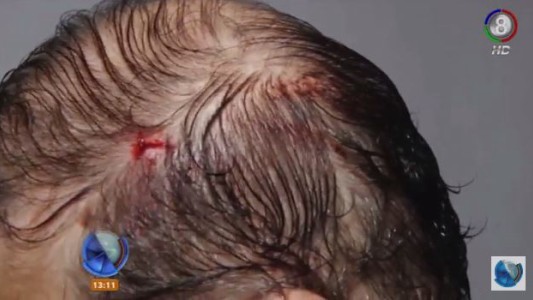 Delincuentes le apuntaron en la cabeza a un bebé para robarles