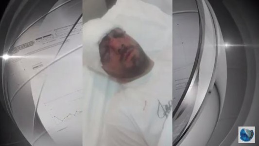 Inseguridad sin límites: Brutal golpiza a un trabajador para robarle la moto