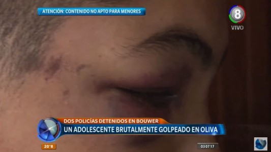 Dos policías detenidos tras brutal golpiza a un adolescente de 16 años