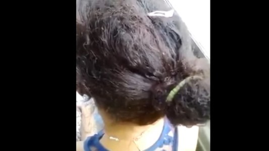 Viral: El video de la chica con la cabeza llena de piojos que viaja en colectivo