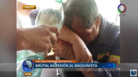 Evoluciona favorablemente el maquinista brutalmente agredido en Malagueño