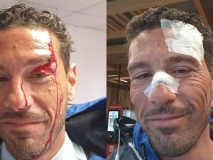 Violento ataque a un chofer: le dieron cinco puntos tras ser golpeado con un alicate